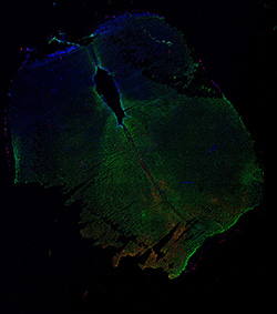 13PCW human midbrain